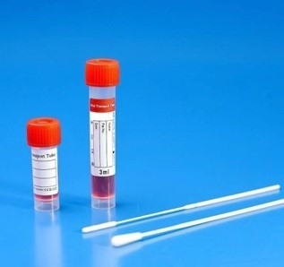150mm scharte sich nasalen Putzlappen für das Virus, das Kit Specimen Collection Of Covid-19 probiert