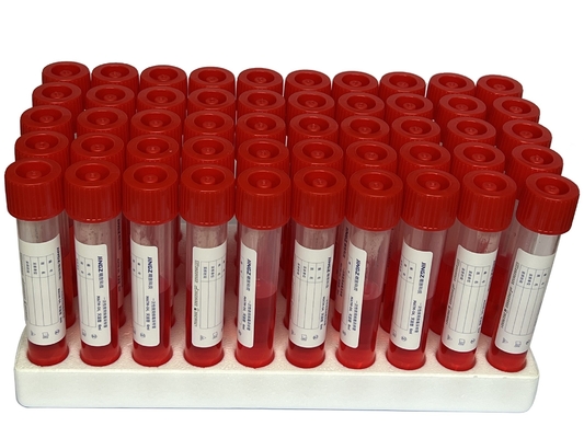 Virus pp. 5ml-10ml, das Kit Vtm Sampling Tube With 2pcs probiert, scharte sich Putzlappen