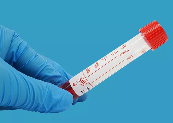 Wegwerf-Virus 10ml, das Kit Nucleic Acid Extraction Kit probiert