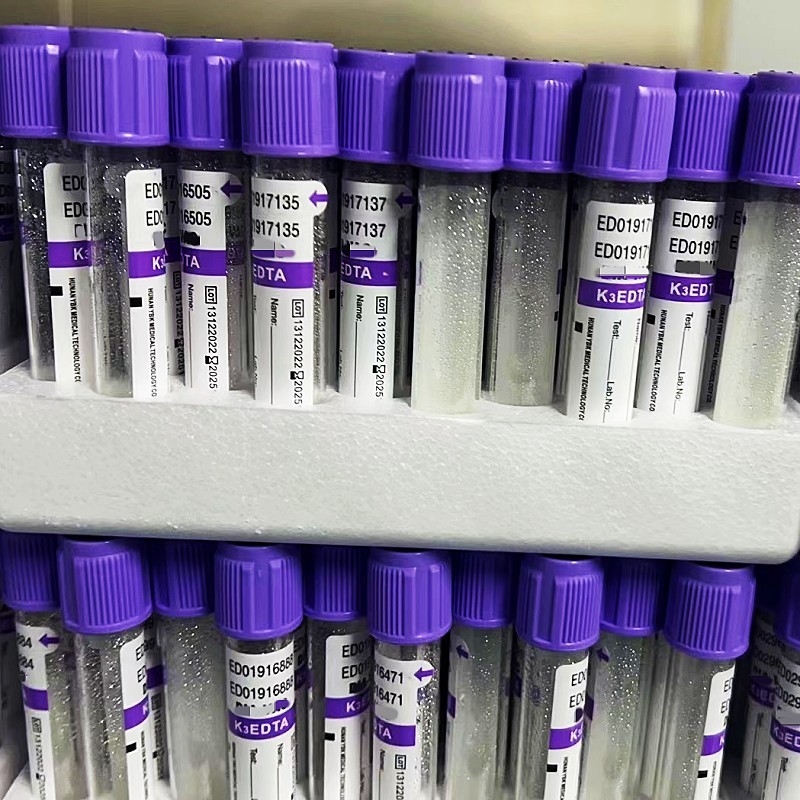 Gestelle des Vakuum-EDTA Blut-Beispielrohr-12/18 pro Zusatz des Karton-3.2mg/ml